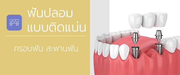 ฟันปลอมแบบติดแน่น ฟันปลอมถาวร ครอบฟัน ครอบฟันหน้า ครอบฟันกราม ครอบฟันขาว ครอบฟันหลุด ครอบฟันชั่วคราว สะพานฟัน สะพานฟันหน้า สะพานฟันหลุด บริการและค่ารักษา AG Dental Plus Clinic ทำฟัน จัดฟัน ปิ่นเกล้า โดยทีมทันตแพทย์มหิดล