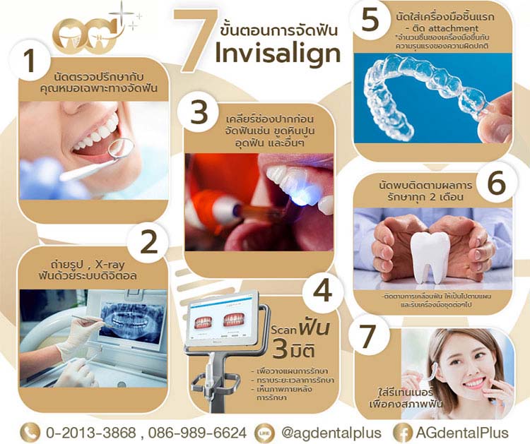 7ขั้นตอนการจัดฟัน-Invisalign-R
