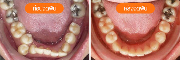 AG Dentalplus Case Review 3 - 2023