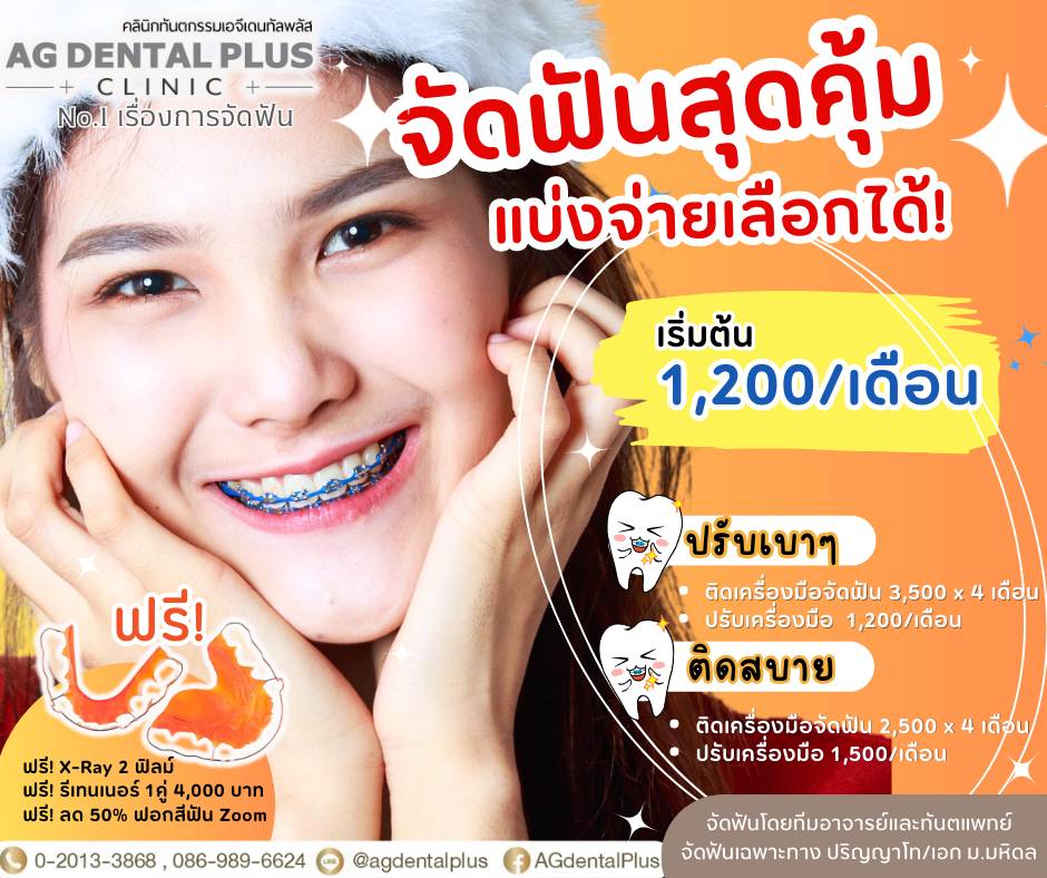 AG Dental Plus Orthodontic Promotion2